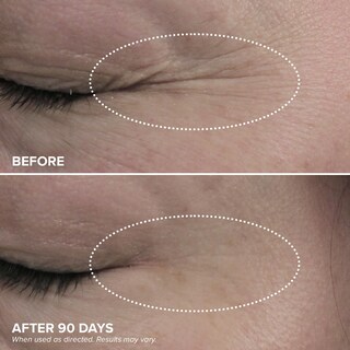 Foto 4 | Foto 4 | Crema De Ojos Drmtlgy Hpr Retinoid Para Debajo De Los Ojos 15 Ml - Venta Internacional.