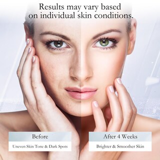 Foto 3 | Foto 3 | Eliminador De Manchas Oscuras Wmk Para Rostro Cuerpo Manos Y Axilas 15 Ml - Venta Internacional.