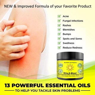 Foto 2 | Foto 2 | Pomada Antiácaros Revitalize Life Organics Mite-e-blast - Venta Internacional.