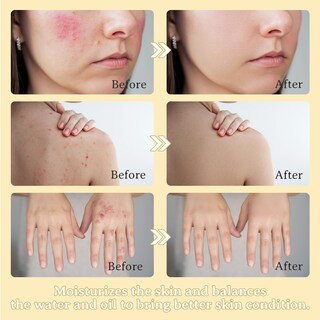 Foto 3 | Foto 3 | Crema Para El Cuidado De La Piel Lionmane Beef Tallow 125ml - Venta Internacional.