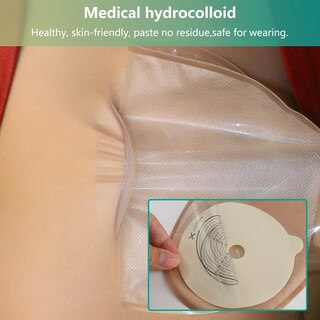 Foto 2 | Foto 2 | Ostomy Bags Vlookup 20 Unidades Bolsas Drenables De Una Sola Pieza - Venta Internacional.