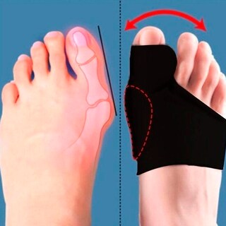 Foto 6 | Foto 6 | Corrector Juanete Separador Dedos Pies Tela Almohadilla Valgus 1 Par