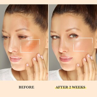 Foto 2 | Foto 2 | Exfoliante Químico Derphea Con 16% De Ácido Salicílico 120 Ml Para Rostro Y Cuerpo - Venta Internacional.