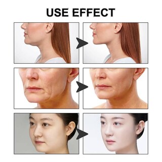 Foto 2 | Foto 2 | Bandas Autoadhesivas Impermeables Invisibles Para Estiramiento Facial 40 Unidades - Venta Internacional.