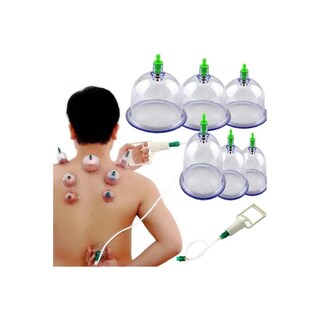 Foto 1 | Foto 1 | Juego De 6 Ventosas Al Vacío Para Terapia De Masaje Estilo Chino - Venta Internacional.