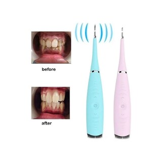 Foto 3 | Foto 3 | Cepillo De Dientes Ultrasónico Dental Tartar Remover X2 Sarro2 - Venta Internacional.