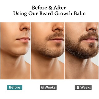 Foto 4 | Foto 4 | Bálsamo Estimulante Para Barba Vbolre Ultra Potent Growth 100 Ml - Venta Internacional.