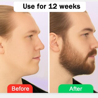 Foto 5 | Foto 5 | Bálsamo Estimulante Para Barba Vbolre Ultra Potent Growth 100 Ml - Venta Internacional.