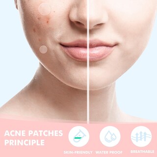 Foto 7 | Foto 7 | Pimple Patches Sunpik Para Rostro Con Ácido Salicílico 230 Unidades - Venta Internacional.