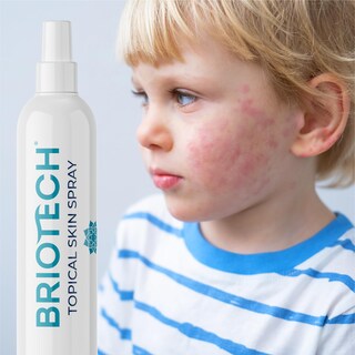 Foto 6 | Foto 6 | Spray De Ácido Hipocloroso Puro Briotech De 100 Ml Para Cuerpo Y Rostro - Venta Internacional.
