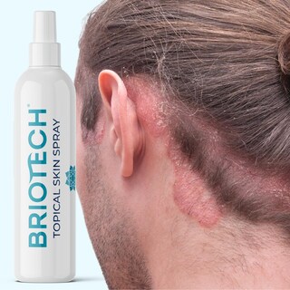Foto 7 | Foto 7 | Spray De Ácido Hipocloroso Puro Briotech De 100 Ml Para Cuerpo Y Rostro - Venta Internacional.