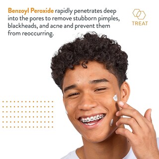 Foto 4 | Foto 4 | Tratamiento Localizado Acnefree Terminator 10 Con Peróxido De Benzoilo Al 10% - Venta Internacional.