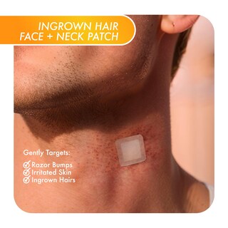 Foto 3 | Foto 3 | Parche De Tratamiento Para El Cabello Encarnado Fazit Para La Zona De La Barba - Venta Internacional.