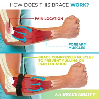 Foto 4 | Foto 4 | Aparato Ortopédico Ortopédico Para Epicondilitis Correa De Codo Compresión - Venta Internacional.