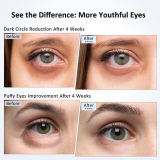 Foto 4 | Foto 4 | Sérum Para Ojos +1 Herolabs Con Cafeína Para Ojeras 20 Ml (paquete De 2) - Venta Internacional.
