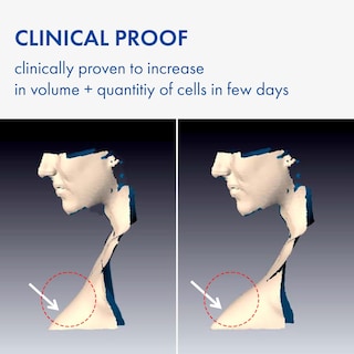 Foto 2 | Foto 2 | Sérum Tosowoong Volufiline 100% France Sederma 11 Ml Para Rostro - Venta Internacional.