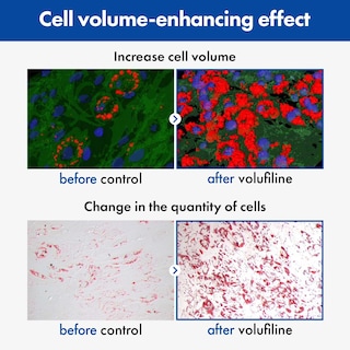 Foto 3 | Foto 3 | Sérum Tosowoong Volufiline 100% France Sederma 11 Ml Para Rostro - Venta Internacional.