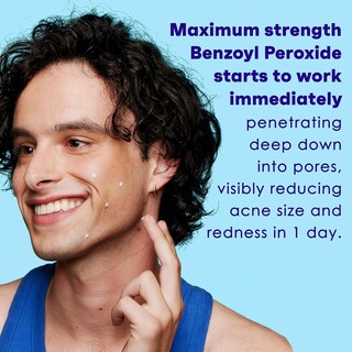 Foto 4 | Foto 4 | Tratamiento Para Manchas De Acné Clean & Clear Persa-gel 10 30 Ml - Venta Internacional.