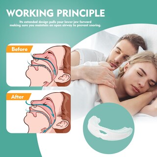 Foto 4 | Foto 4 | Dispositivo Antirronquidos Tangdiaabbcc Portátil Y Ajustable - Venta Internacional.