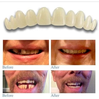 Foto 6 | Foto 6 | Kit De Dientes Temporales Para Reparación Dental Y Reemplazo De Dientes - Venta Internacional.