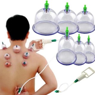 Foto 1 | Foto 1 | Set De Ventosas Al Vacío Ayunan Massage Therapy 6 Tazas - Venta Internacional.