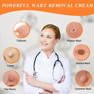 Foto 7 | Foto 7 | Pomada Congelante En Gel De Acción Rápida Bighero Remover Wart Remover Paquete De 2 - Venta Internacional.