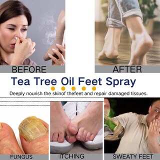 Foto 6 | Foto 6 | Spray Para Pies Uioecn Con Aceite De Árbol De Té Para Mantener Frescos Los Pies Y Los Zapatos - Venta Internacional.