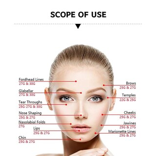 Foto 3 | Foto 3 | Puntas Romas Desechables Para Estiramiento Facial De 18 A 30 G (5 Unidades) - Venta Internacional.