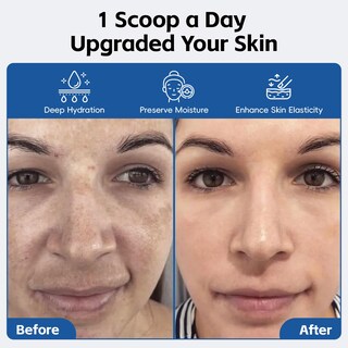 Foto 5 | Foto 5 | Sérum Hidratante Arofum Diy En Polvo De Ácido Hialurónico 100 G - Venta Internacional.