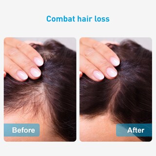 Foto 6 | Foto 6 | Cinturón De Terapia De Luz Roja Cerca Del Infrarrojo Para Bajar De Peso - Venta Internacional.