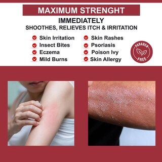Foto 2 | Foto 2 | Crema Contra La Picazón Quatriderm Nf Extra Strength Con Hidrocortisona Al 1% - Venta Internacional.