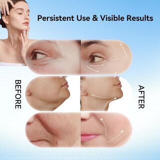 Foto 5 | Foto 5 | Masajeador Facial Ihelol 3 En 1 Con Vibración Y Tratamiento Térmico - Venta Internacional.
