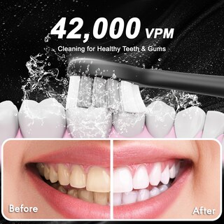 Foto 6 | Foto 6 | Cepillo De Dientes Eléctrico Kuicur Diamond Style Sonic 42.000 Vpm - Venta Internacional.