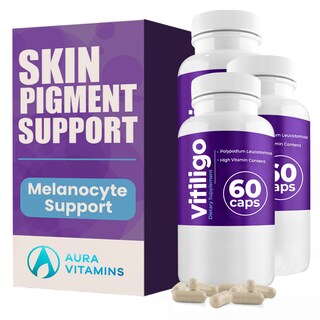 Foto 1 | Foto 1 | Cápsulas Para Vitíligo Aura Vitamins 60 Unidades Suministro De 1 Mes - Venta Internacional.