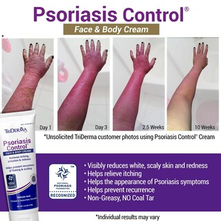 Foto 2 | Foto 2 | Crema Triderma Para El Control De La Psoriasis Para Rostro Y Cuerpo 125 Ml - Venta Internacional.
