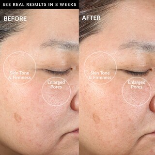 Foto 4 | Foto 4 | Dispositivo De Limpieza Facial Pmd Clean Con Cepillo De Silicona Resistente Al Agua - Venta Internacional.