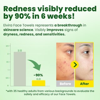 Foto 2 | Foto 2 | Toallas Faciales Desechables Elvira 100 Unidades Biodegradables - Venta Internacional.