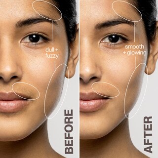 Foto 5 | Foto 5 | Dispositivo Exfoliante Antienvejecimiento Dermaflash Luxe+ Para Depilación - Venta Internacional.
