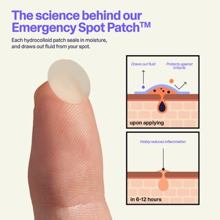 Foto 4 | Foto 4 | Pimple Patches Hidrocoloide Curology Emergency Spot 40 Unidades - Venta Internacional.