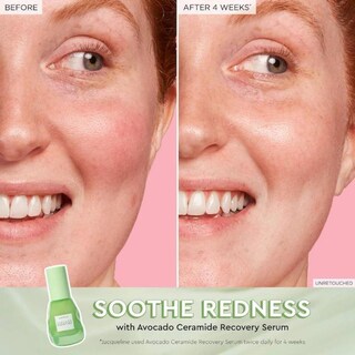 Foto 5 | Foto 5 | Set De Cuidado De La Piel Navideño Glow Recipe Que Calma Resplandece Y Brilla - Venta Internacional.