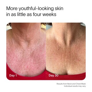 Foto 4 | Foto 4 | Mascarilla Rejuvenecedora De Cuello Y Pecho Solawave Con Luz Roja E Infrarroja - Venta Internacional.