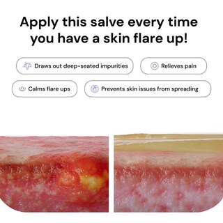 Foto 6 | Foto 6 | Flare Care Solution Universal Relief 97% De Problemas De Piel 120 Ml - Venta Internacional.