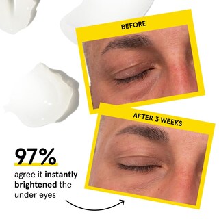 Foto 2 | Foto 2 | Crema Para Ojos Lumin Dark Circle Defense Balm 20 Ml Antienvejecimiento - Venta Internacional.