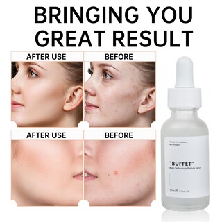 Foto 6 | Foto 6 | Sérum Mizeeye Buffet Peptides 30 Ml Hidratante Antienvejecimiento - Venta Internacional.