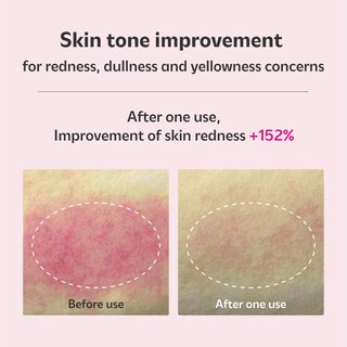 Foto 3 | Foto 3 | Serum Isoi Blemish Care Up 35 Ml Con Arbutina Y Aceite De Rosa Búlgara - Venta Internacional.