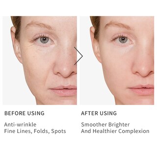 Foto 5 | Foto 5 | Sérum Hkh Vitamina C Con Ácido Hialurónico Vitamina E Para Rostro - Venta Internacional.