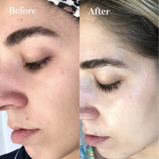 Foto 5 | Foto 5 | Crema Hidratante Saturday Skin Zanahoria Niacinamida 50ml - Venta Internacional.