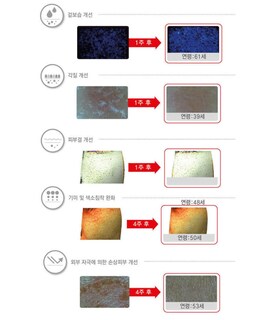 Foto 5 | Foto 5 | Sérum Dongkook Centellian 24 Microscópicos De 50 Ml Con Teca Tech - Venta Internacional.