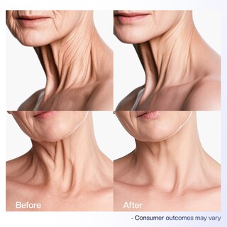 Foto 4 | Foto 4 | Crema Para El Cuello Jtopyrt Reafirmante Reafirmante Antienvejecimiento 50 Ml - Venta Internacional.