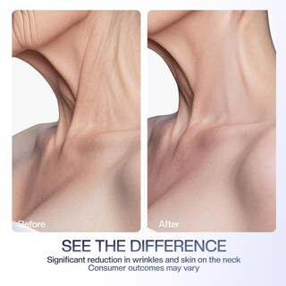 Foto 5 | Foto 5 | Crema Para El Cuello Jtopyrt Reafirmante Reafirmante Antienvejecimiento 50 Ml - Venta Internacional.